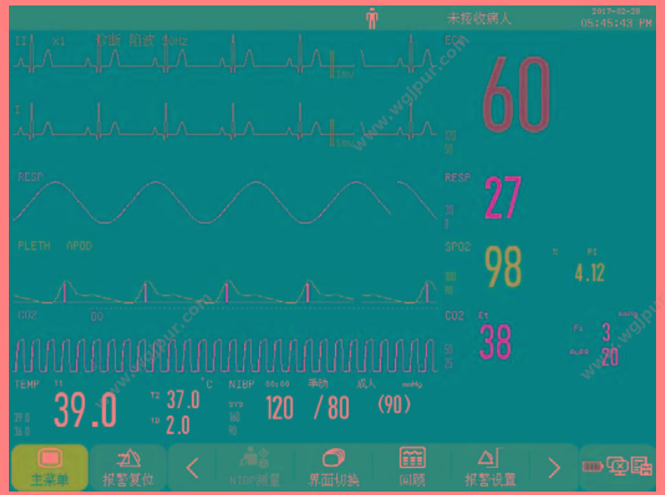 科曼 COMEN STAR8000E（三导联） 病人监护仪