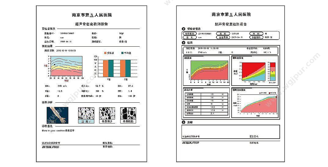 科进 Kejin OSTEOKJ7000++双屏 超声骨密度仪