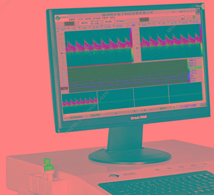 瑞华 超声经颅多普勒血流分析仪 RH-3200 经颅多普勒