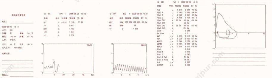 麦邦 M&B MSA99（便携式） 肺功能仪