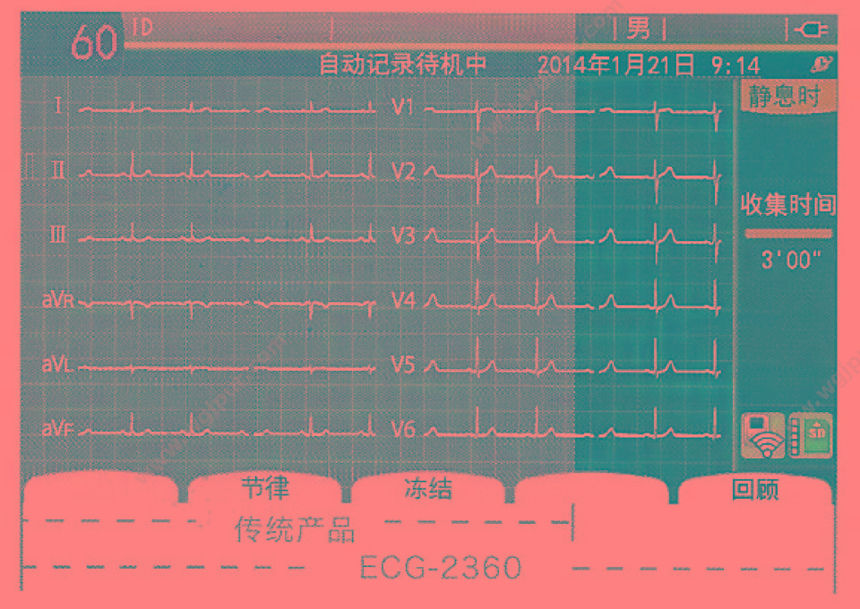 日本光电 NIHON KOHDEN 心电图机 ECG-2360 心电图机