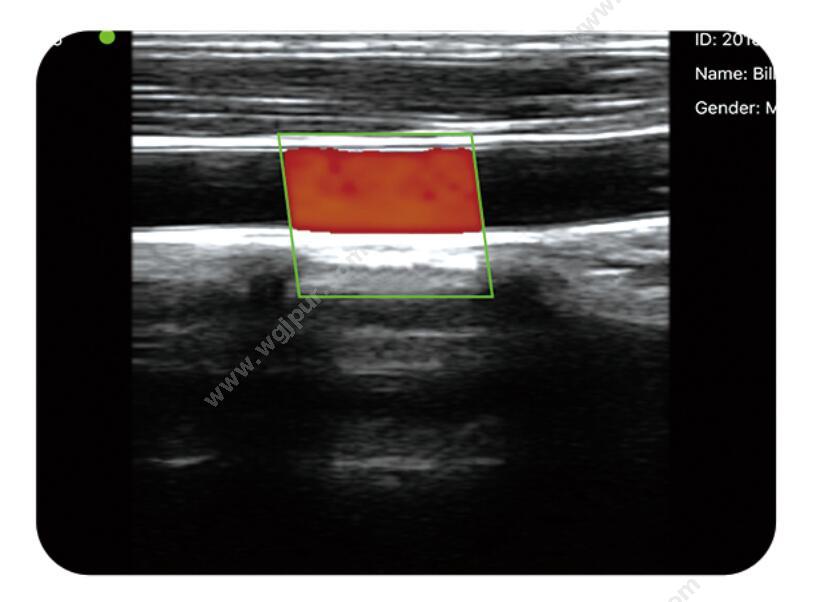 索诺星 SonoStar 掌上彩色多普勒超声显像仪 CScan 彩超