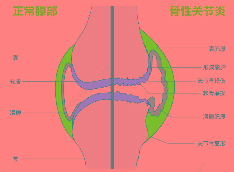 泰步 复合超声关节炎治疗仪 TY-LS-100 超声波治疗仪