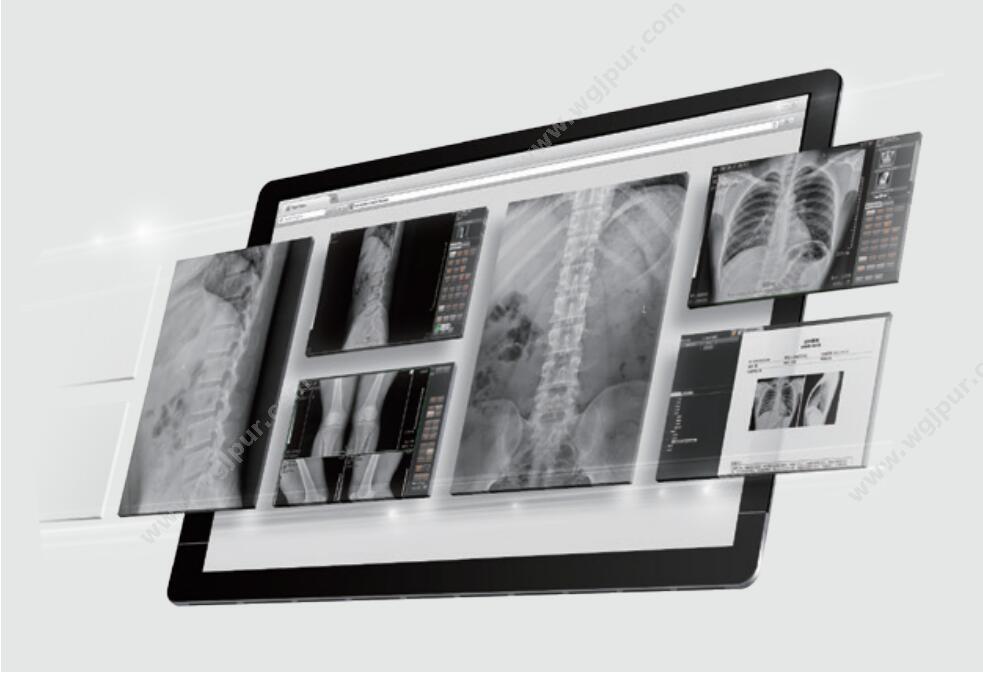 宽腾 数字化车载X射线机 RayNova DRvs 数字DR