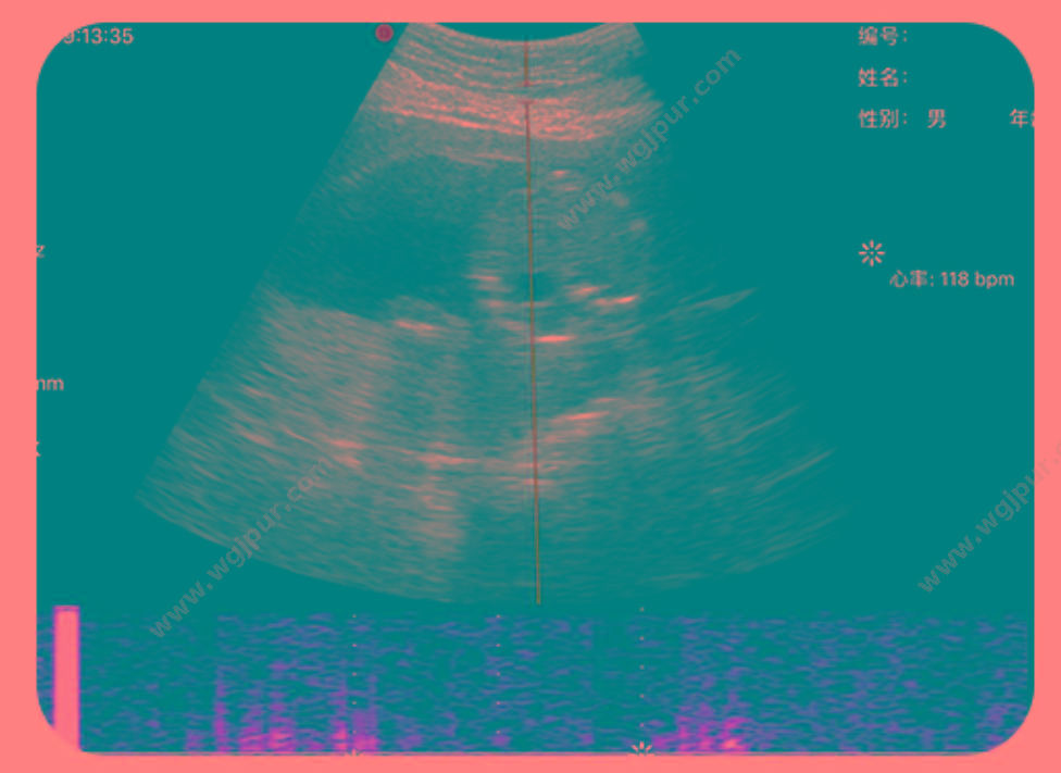 索诺星 SonoStar 全数字超声显像诊断仪 掌上超声 CProbe（线阵） 彩超