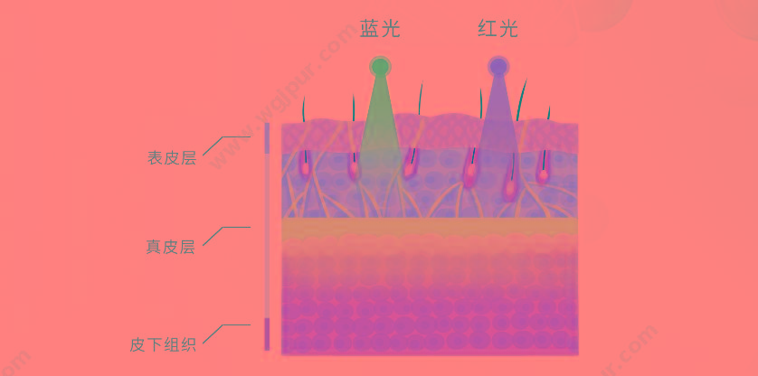 时代阳光 红蓝光谱治疗仪 YGL450-C（弧形） 蓝光治疗仪