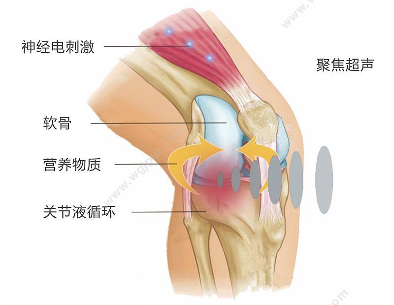 泰步 复合超声关节炎治疗仪 TY-LD-200 超声波治疗仪