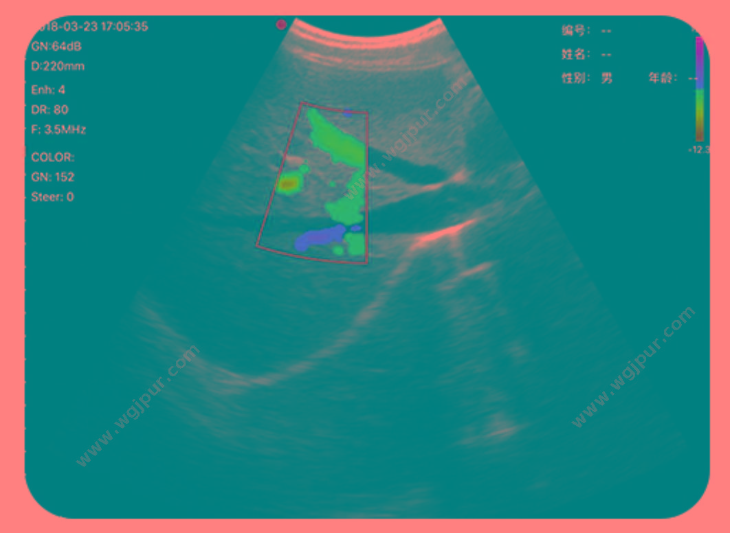 索诺星 SonoStar 全数字超声显像诊断仪 掌上超声 CProbe（线阵） 彩超