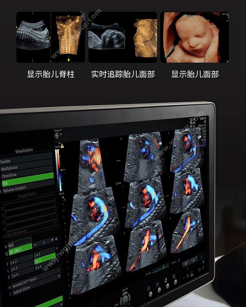 GE医疗 彩色超声诊断仪 VOLUSON S6 （腹部C1+腹部容积RS+腔内IC9） 彩超