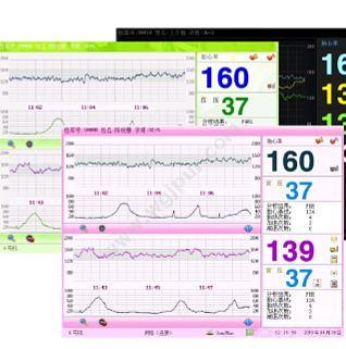 三瑞 Sunray 电脑胎儿监护仪 SRF618B6（标准型） 母胎监护仪