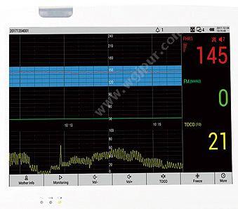 莱康宁 LUCKCOME 胎儿/孕妇/病人多参数监护仪 L8P（九参数母胎监护仪） 母胎监护仪