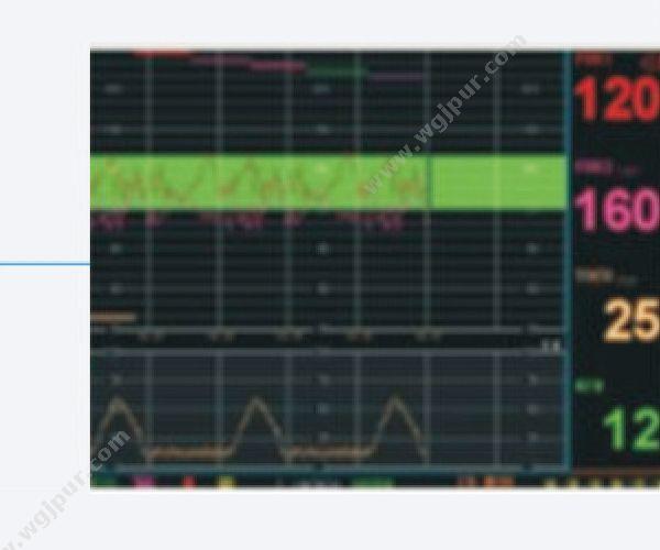 艾瑞康 Aricon 胎儿监护仪 FM-6B（三参数） 母胎监护仪