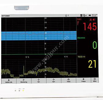 莱康宁 LUCKCOME 胎儿/孕妇/病人多参数监护仪 L8P（六参数母胎监护仪) 母胎监护仪