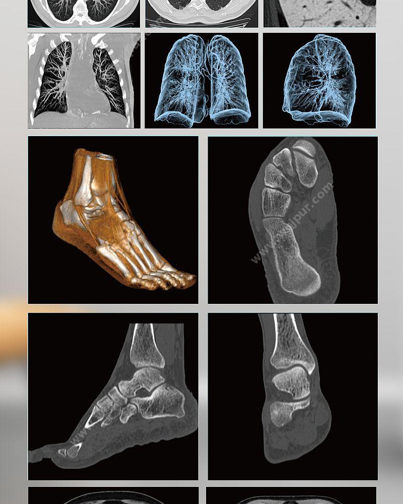 GE医疗 16排螺旋CT X射线计算机体层摄影设备 Revolution ACTs铂金版16层 CT