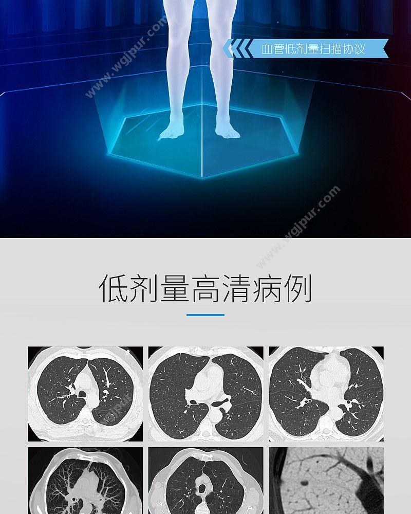 GE医疗 16排CT X射线计算机体层摄影设备 Revolution ACTs钻石版32层 CT