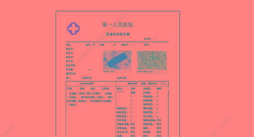 信达 XINDA 医学影像工作站 XD-6000X（白带动静态图像检测） 精子分析仪