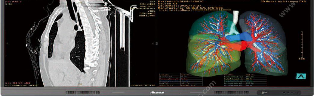 海信 Hisense 会诊显示器 HMC65M5A 医用显示器