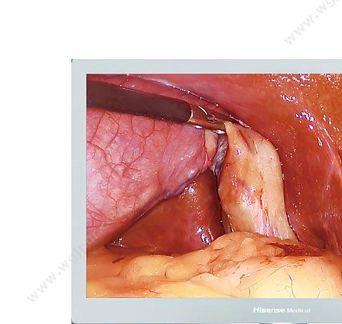 海信 Hisense 医用内窥显示器 HME8C32E 医用显示器