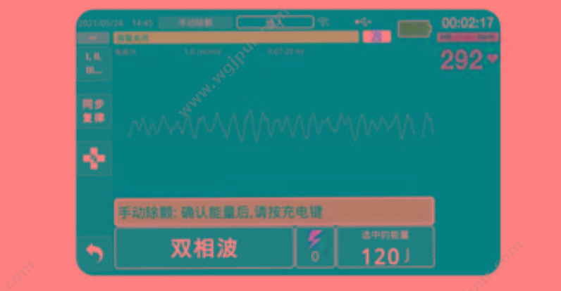 卓尔 ZOLL 体外除颤监护仪 ZOLL M2 除颤监护仪